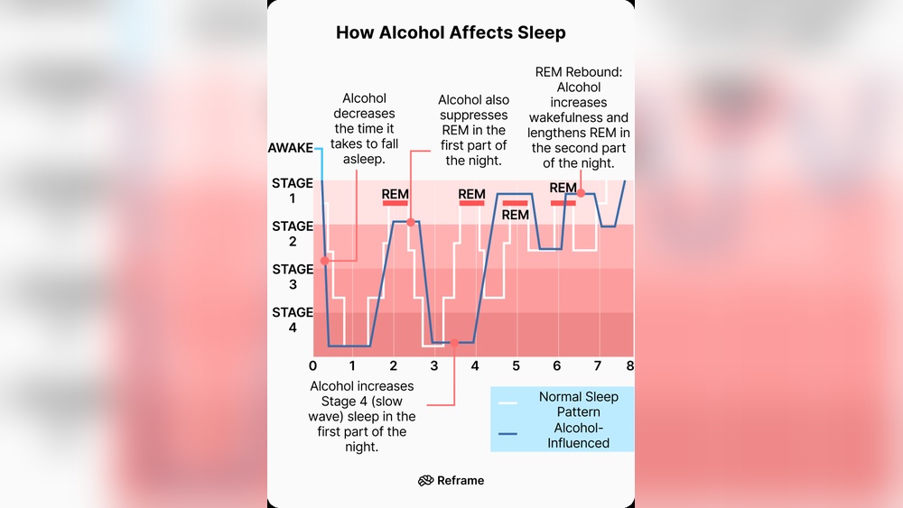 Alcohol And Rem Sleep Suppression