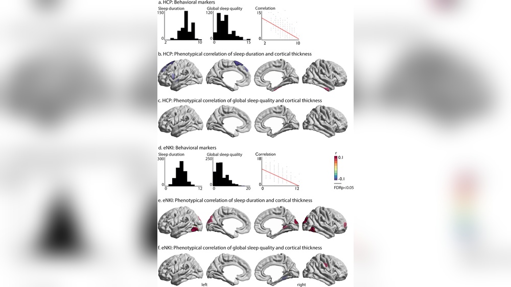 Does Sleep Only Matter for Physical Health?