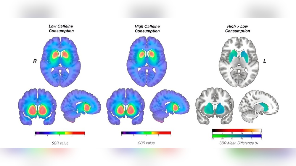 How Caffeine Affects the Brain
