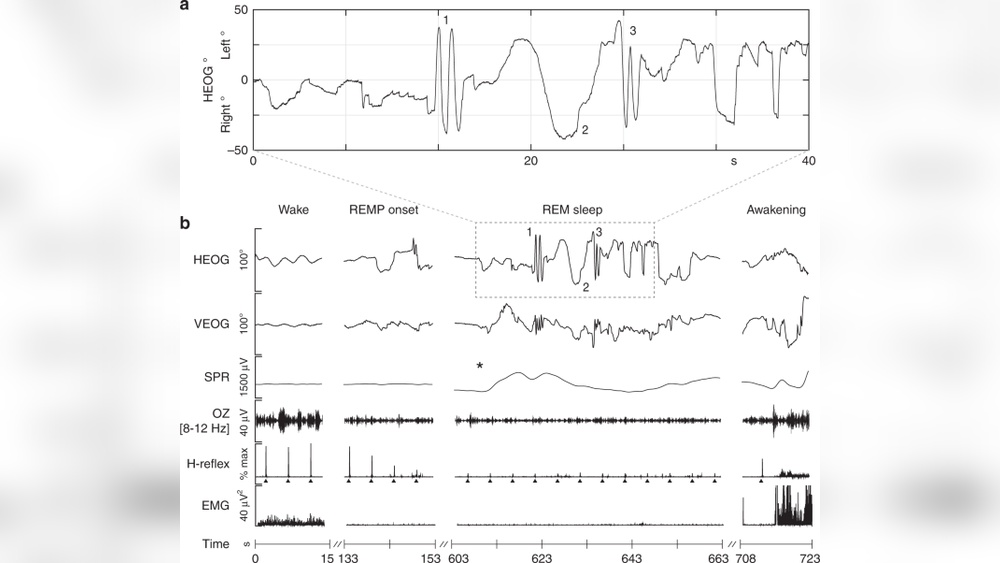 How Movement Is Tracked During Sleep