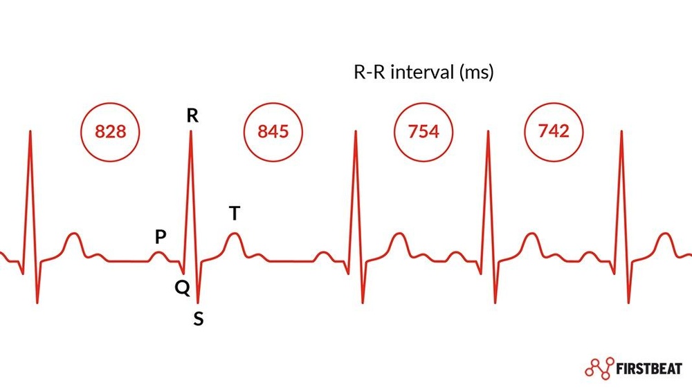 What Is Heart Rate Variability (Hrv)?