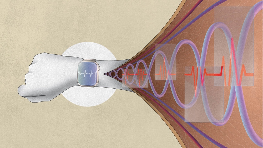 Why Sleep Trackers Aren’T Medical Devices